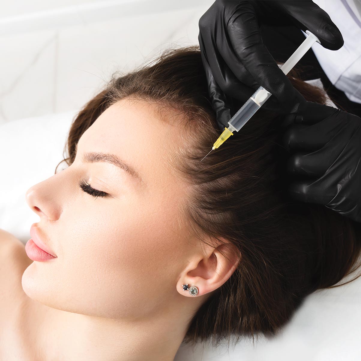 Hair restoration