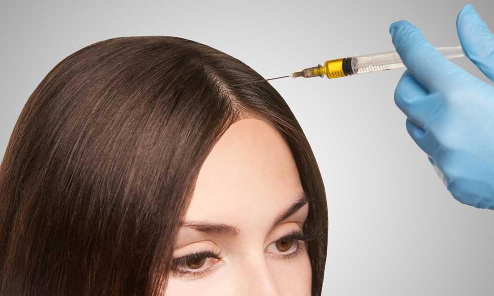 Hair restoration treatment